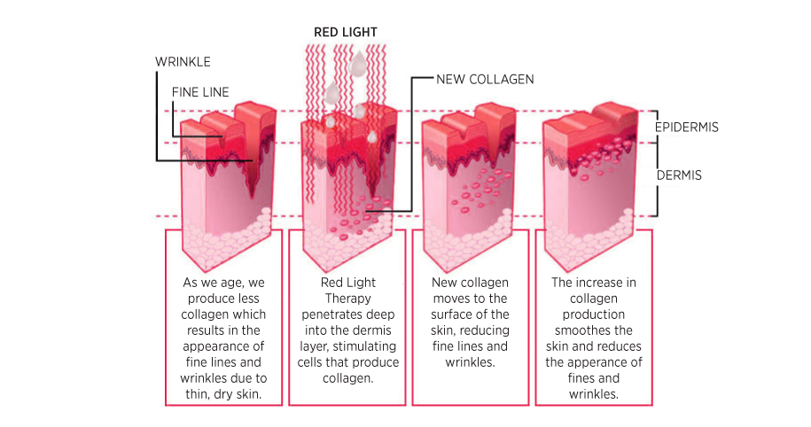 Terapija z rdečo svetlobo Maribor.Fotobiomodulacija za regeneracijo telesa.RLT terapija Lina-Vita Maribor.Bližnja infrardeča svetloba za zdravje.
